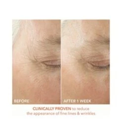 Dr Dennis Gross Alpha Beta Ultra Gentle Daily Peel -Babor Store Alpha Beta Ultra Gentle Daily Peel add2 65347 812 general