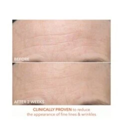 Dr Dennis Gross Alpha Beta Ultra Gentle Daily Peel -Babor Store Alpha Beta Ultra Gentle Daily Peel add3 65347 7832 general