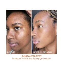 Dr Dennis Gross Alpha Beta Universal Daily Peel -Babor Store Alpha Beta Universal Daily Peel add4 55577 3617 general